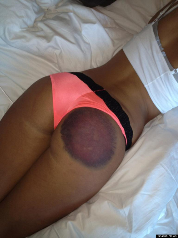 Playboy model Elizabeth Dickson,Элизабет Диксон судится с Playboy, 500 000$ за неудачную партию в гольф 