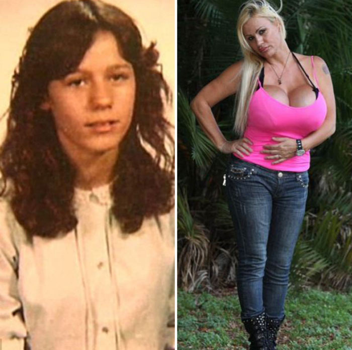 Лэйси Уайлдд - женщина, которая хочет сделать себе самую большую грудь в мире