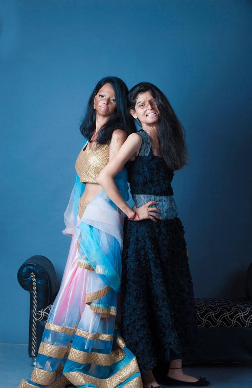 Rahul Saharan Рахул Сахара, облитые кислотой индия