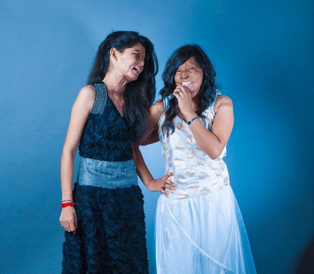 Rahul Saharan Рахул Сахара, облитые кислотой индия