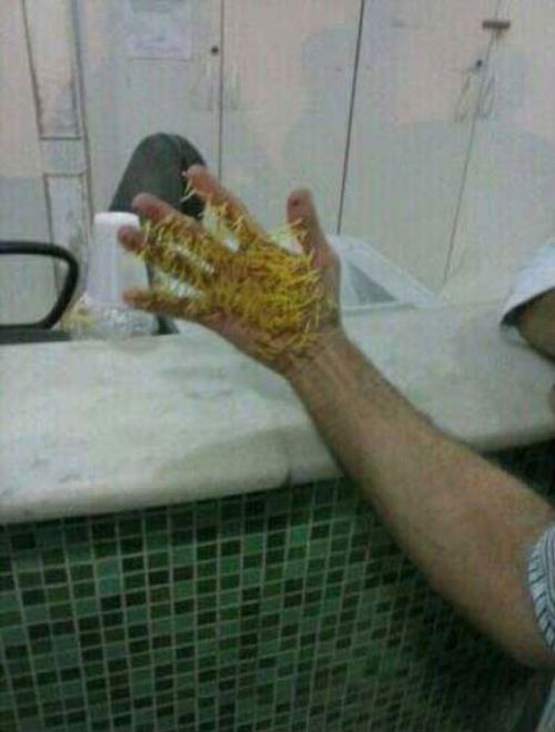 Перепутал опоссума и дикобраза, Антонио Родригес Мороро Antonio Rodrigues Mororó, схватил дикобраза