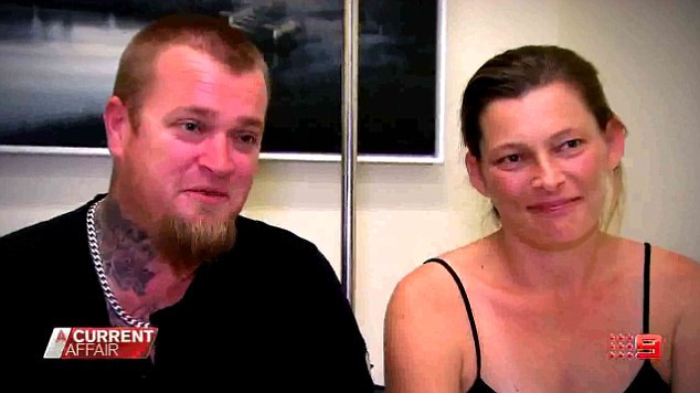 В Австралии родились сиамские близнецы, у которых одно тело на двоих, но два мозга Дипрозоп сиамские близнецы, симаские близнецы два лица и два мозга, Рене Янг, Саймон Хоуи