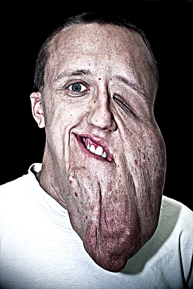 Сирил Кейн Cyril Caine, люди после реконструкции лица