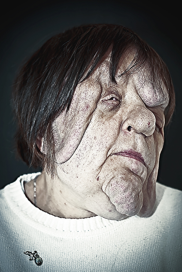 Сирил Кейн Cyril Caine, люди после реконструкции лица