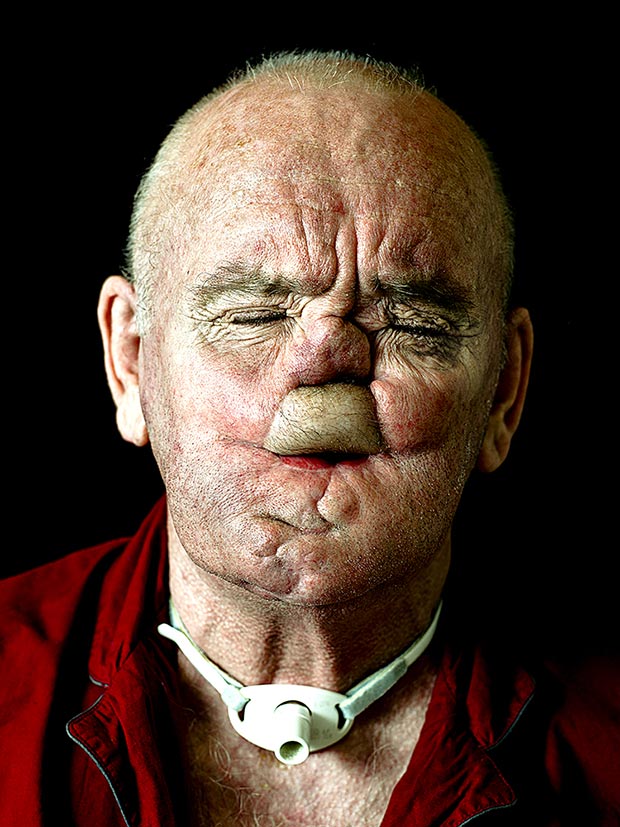 Сирил Кейн Cyril Caine, люди после реконструкции лица