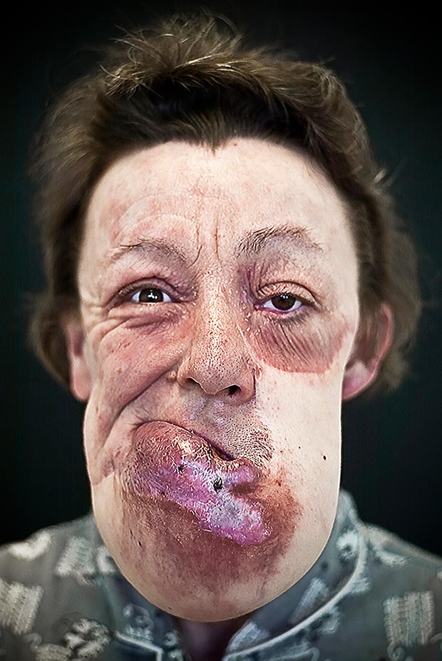 Сирил Кейн Cyril Caine, люди после реконструкции лица