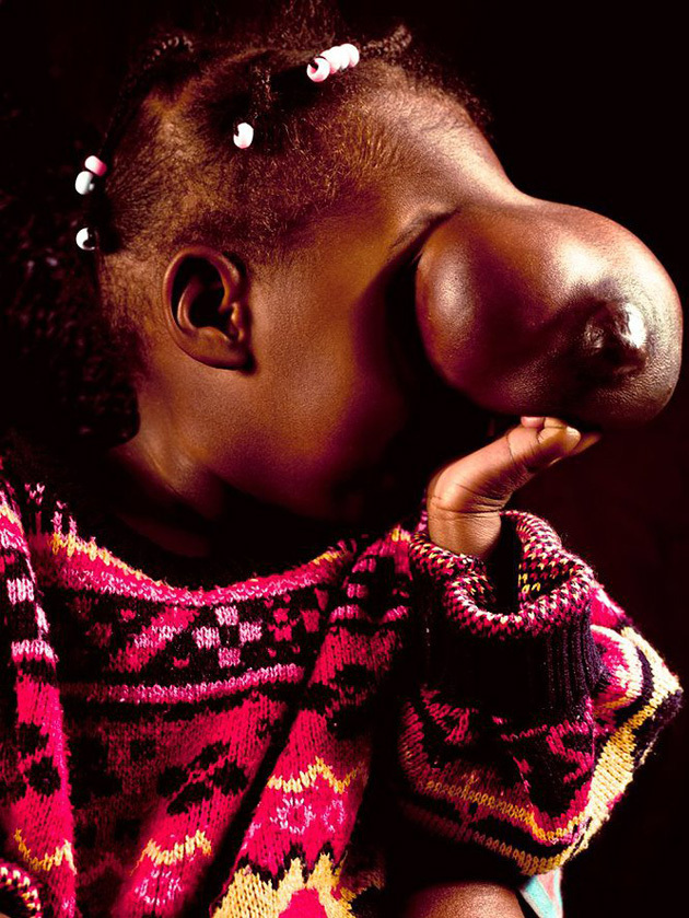 Сирил Кейн Cyril Caine, люди после реконструкции лица