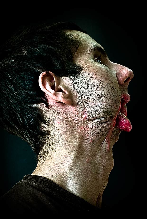 Сирил Кейн Cyril Caine, люди после реконструкции лица