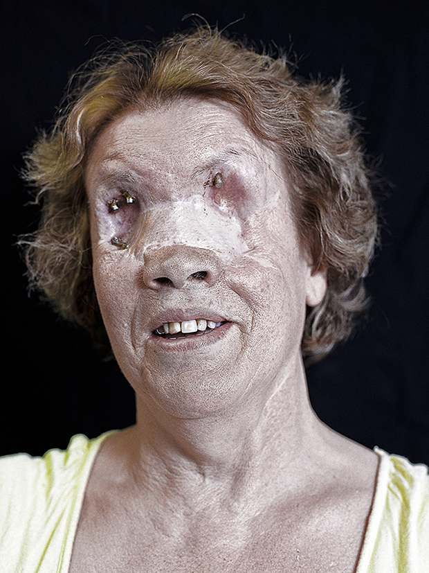 Сирил Кейн Cyril Caine, люди после реконструкции лица