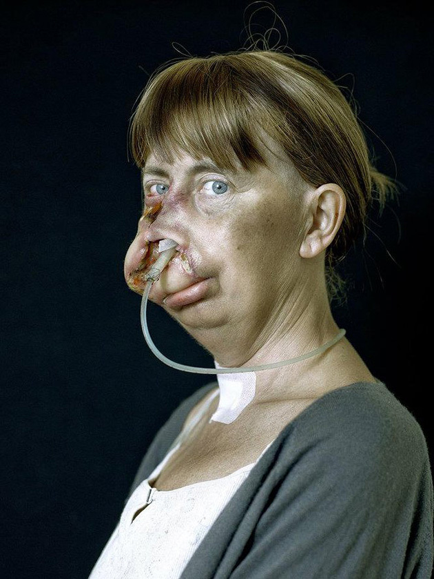 Сирил Кейн Cyril Caine, люди после реконструкции лица