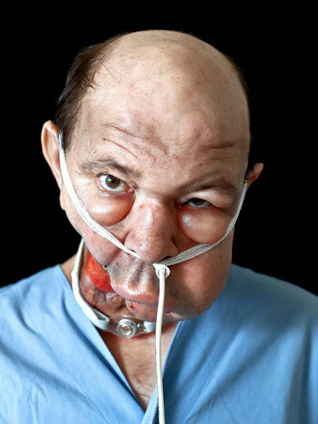 Сирил Кейн Cyril Caine, люди после реконструкции лица