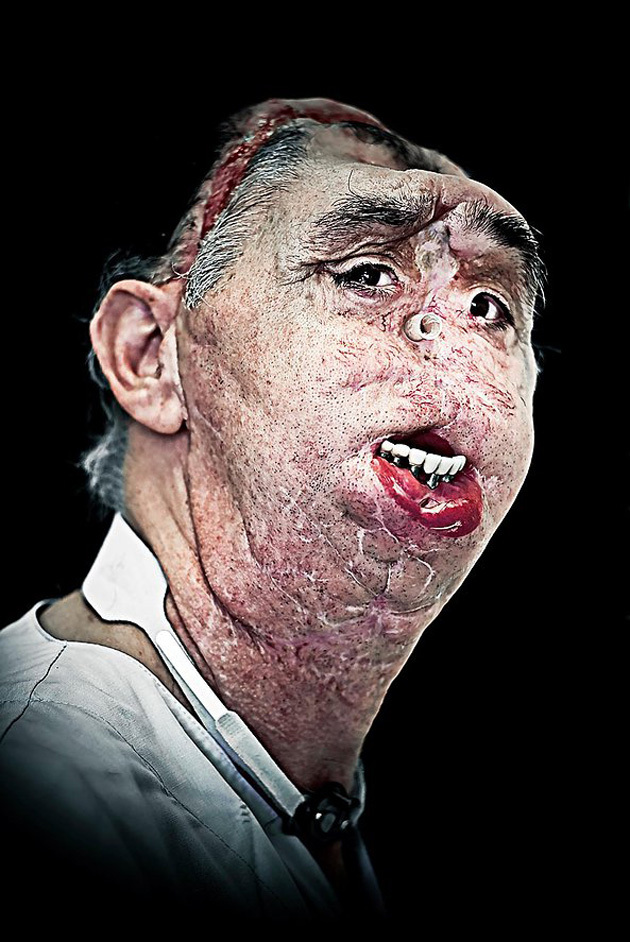 Сирил Кейн Cyril Caine, люди после реконструкции лица