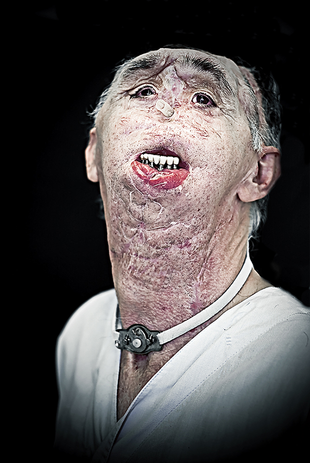 Сирил Кейн Cyril Caine, люди после реконструкции лица