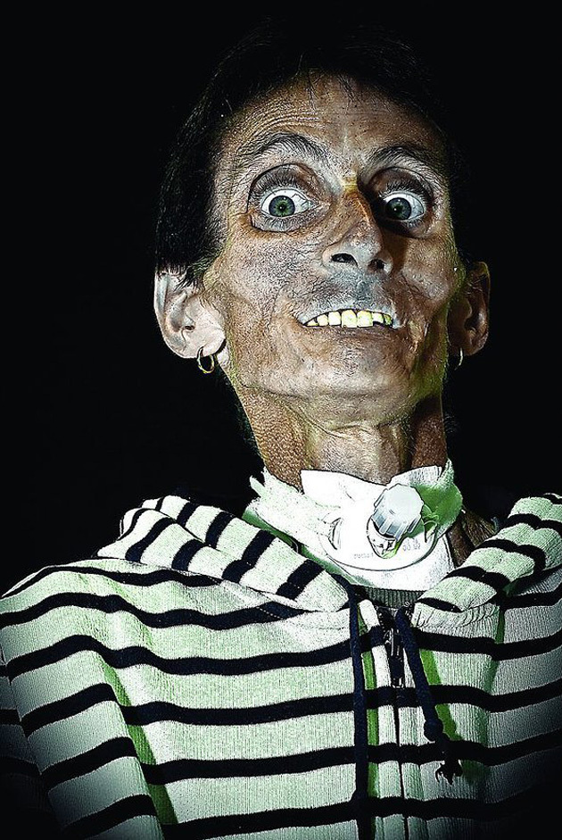 Сирил Кейн Cyril Caine, люди после реконструкции лица