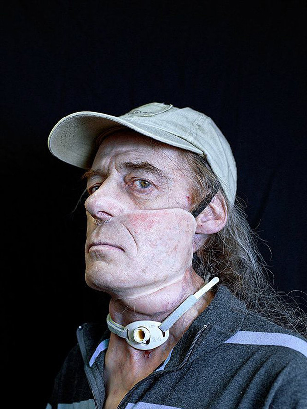 Сирил Кейн Cyril Caine, люди после реконструкции лица