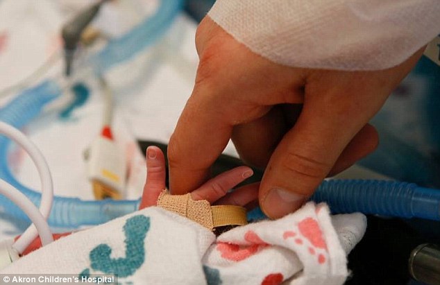 Женщина родила близнецов, которые появились на свет держась за руки Дженна и Джилианна, близнецы держались за руки, Сара Тистлтуэйт, Sarah Thistlethwaite