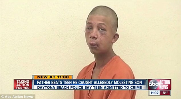 Лицо пeдoфилa, после того как его чуть не избил до смерти разъяренный отец ребенка Рэймонд Флорандер, Raymond Frolander, Джейсона Браунинга, Jason Browning