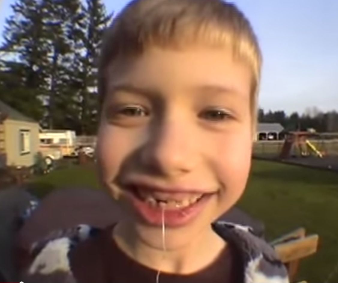 Зачем идти к стоматологу, когда зуб можно вырвать при помощи ракеты вырвал зуб ракетой, сын ракета зуб, Брэдли Харрис, Bradley Harris