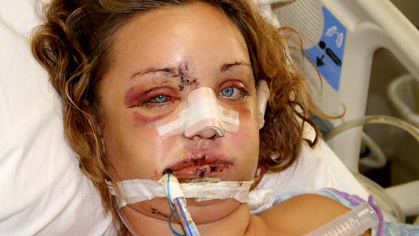 24 человека, которым чудом удалось выжить, после падения с большой высоты люди выжили после падения, истории выживших после падения, люди выжили после падения с высоты