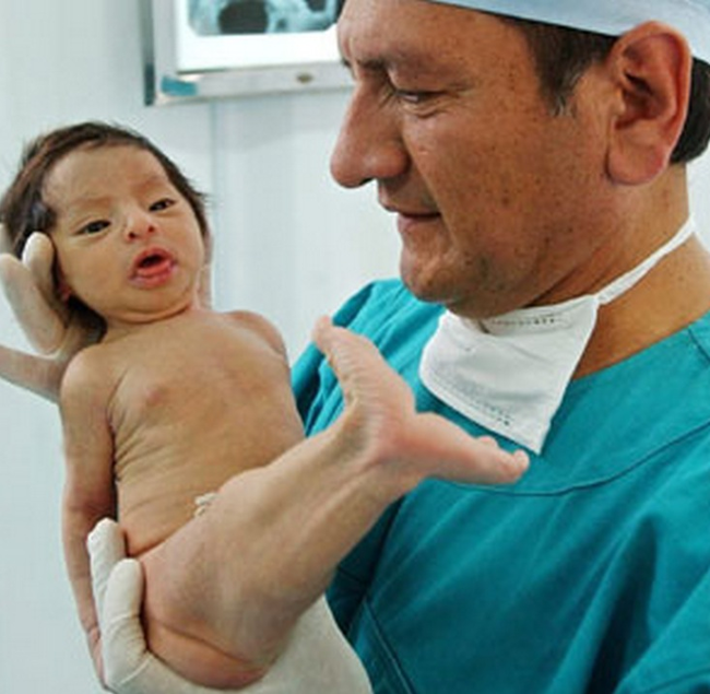 врожденные болезни детей, врожденные дефекты у детей, детские синдромы