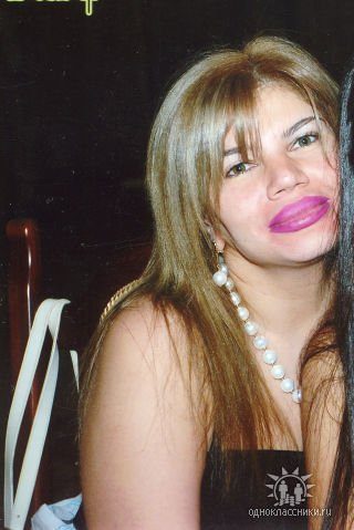 ботокс в губах, гламурные девушки, накаченные губы