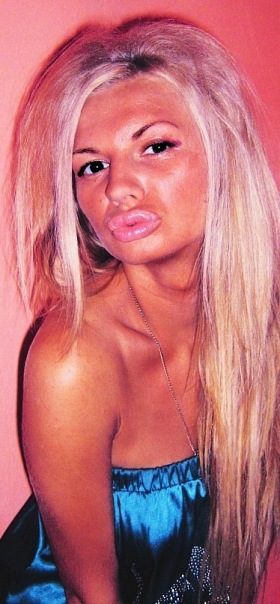 ботокс в губах, гламурные девушки, накаченные губы