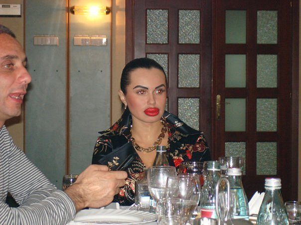 ботокс в губах, гламурные девушки, накаченные губы