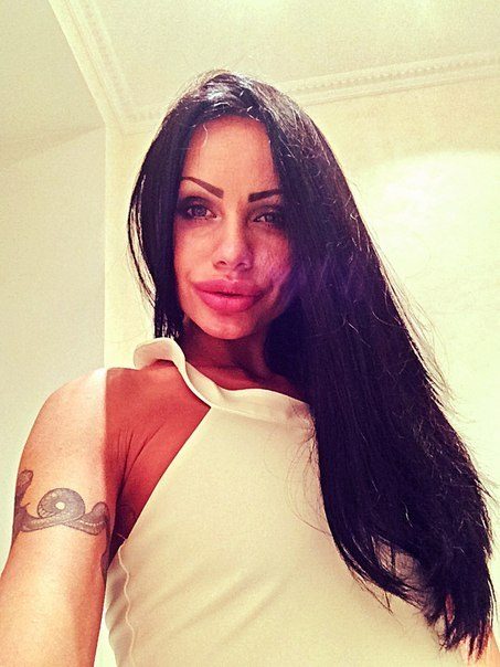 ботокс в губах, гламурные девушки, накаченные губы