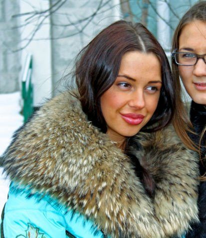 ботокс в губах, гламурные девушки, накаченные губы