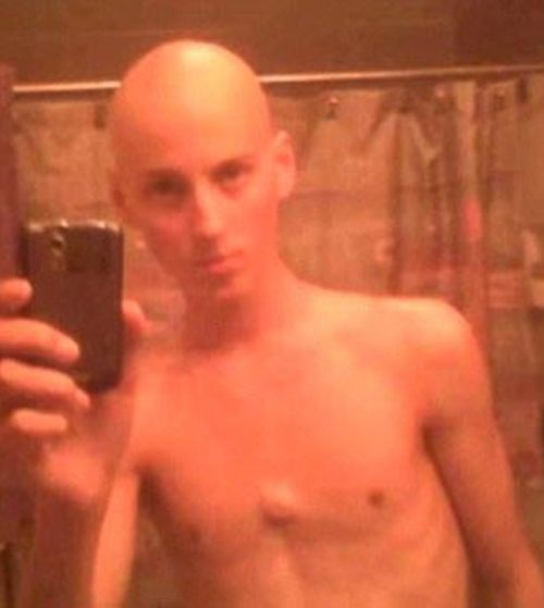 Заку Зейлеру, Zach Zeiler, победил рак и накачал мышцы, после лечения рака занялся бодибилдингом