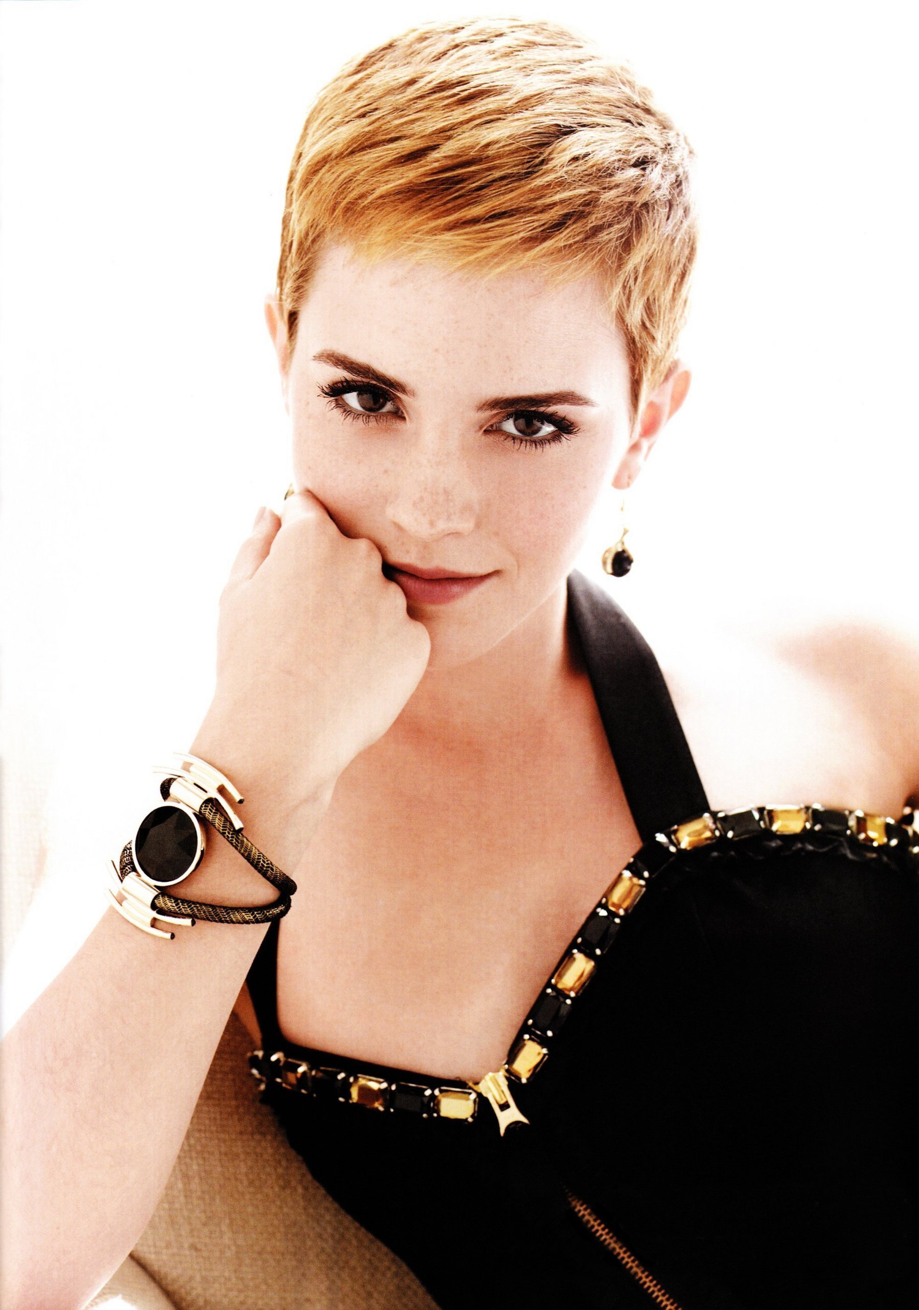 Лопоухие звезды, ушастые знаменитости, звёзды Голливуда которым не повезло с ушами 