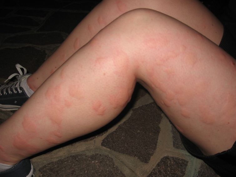 25 людей, у которых лето проходит гораздо хуже, чем у вас неудачное лето, херовое лето, приколы люди лето, как проходит лето