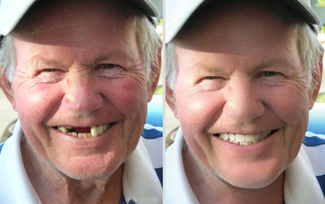 фото людей до и после фотошопа, фотографии до и после цифровой обработки, мощь фотошопа, фотошоп творит чудеса, сила фотошопа