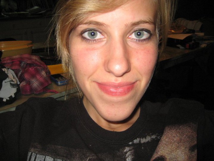 Невероятное преображение лица девушки после пластической операции по изменению нижней челюсти до и после челюстной хирургии, до и после пластической операции на челюсти, девушка после операции на челюсти