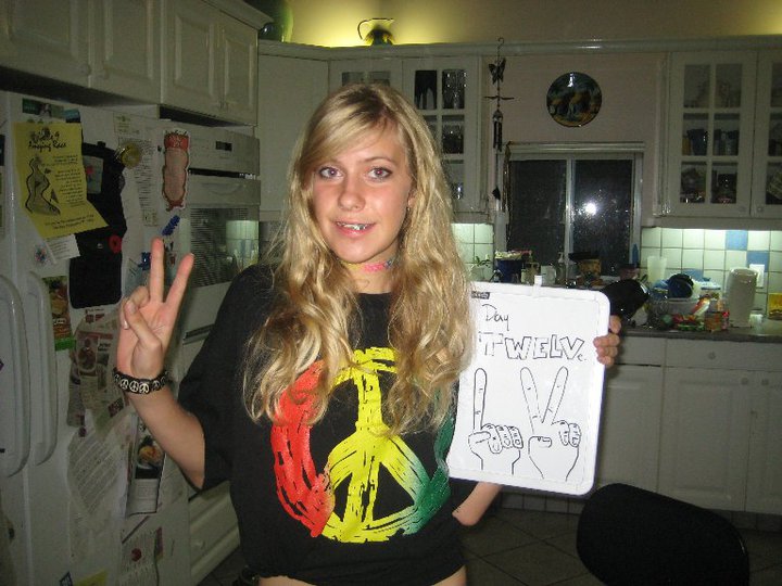 Невероятное преображение лица девушки после пластической операции по изменению нижней челюсти до и после челюстной хирургии, до и после пластической операции на челюсти, девушка после операции на челюсти