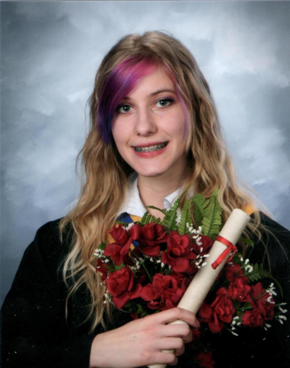 Невероятное преображение лица девушки после пластической операции по изменению нижней челюсти до и после челюстной хирургии, до и после пластической операции на челюсти, девушка после операции на челюсти