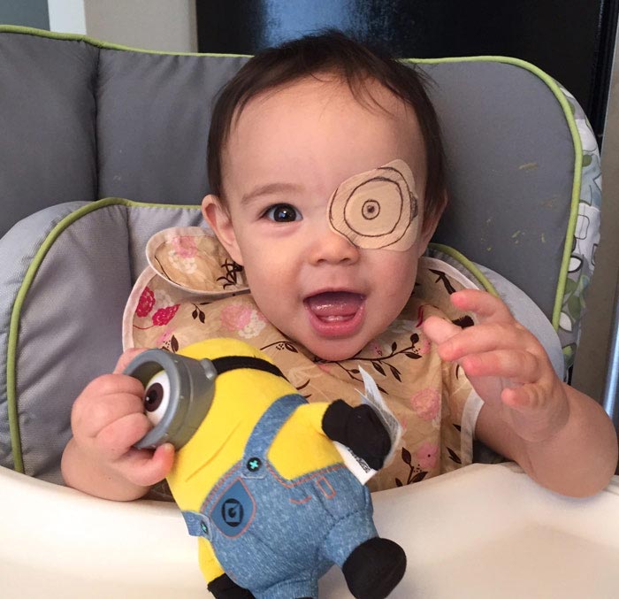 Девочка с повязкой на глазу и её креативный папа, который нашёл выход из непростой ситуации Reddit Gfgrubb, повязка на глазу