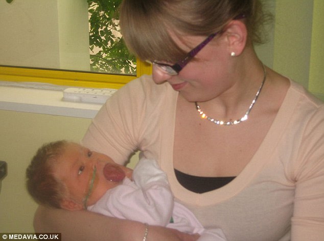 огромный язык, синдром Беквита-Видемана, Оливия Гиллис