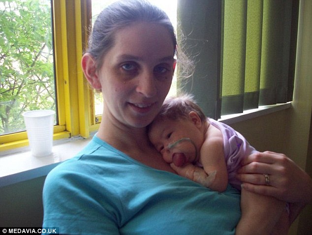 огромный язык, синдром Беквита-Видемана, Оливия Гиллис