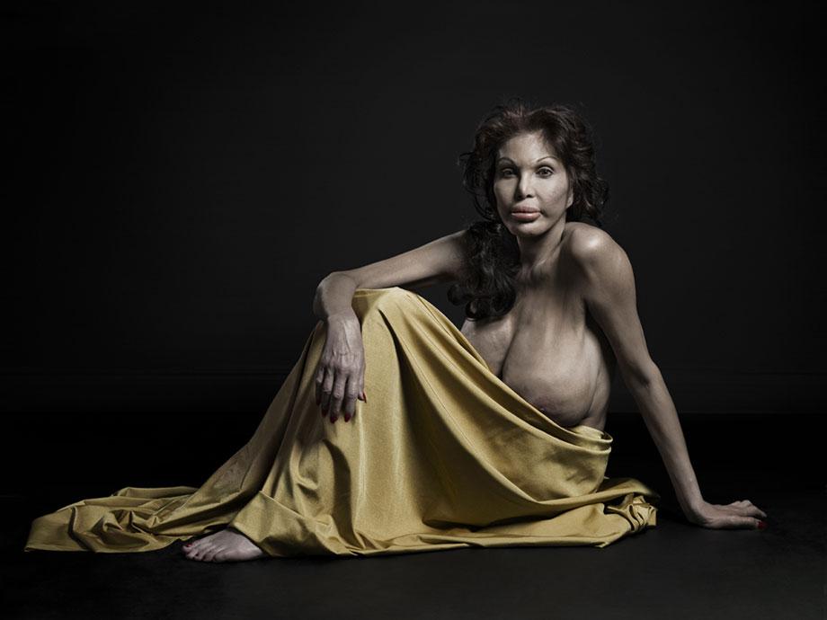 Филлипп Толедано, A New Kind of Beauty, новый вид красоты