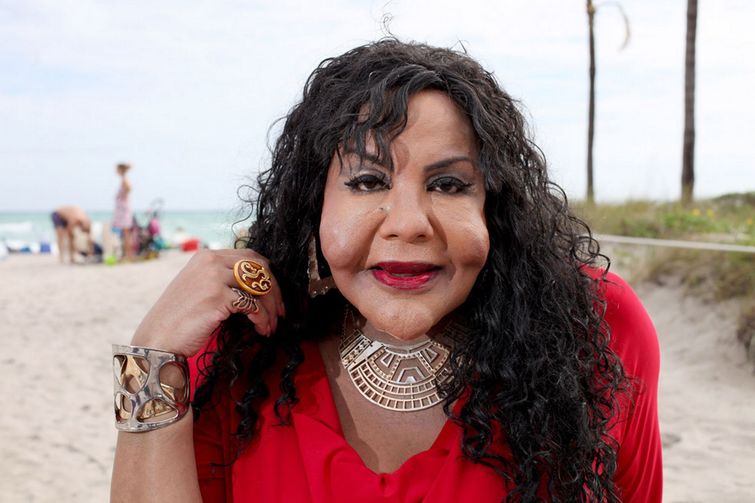 пластическая хирургия монстры, жертвый пластических операций, пластика превратились в монстров