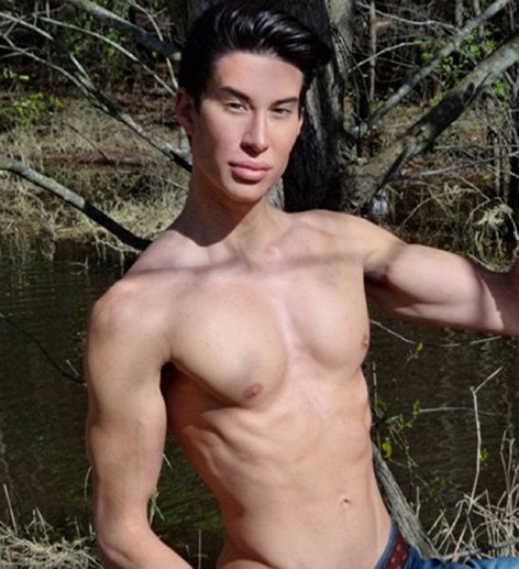 пластическая хирургия монстры, жертвый пластических операций, пластика превратились в монстров