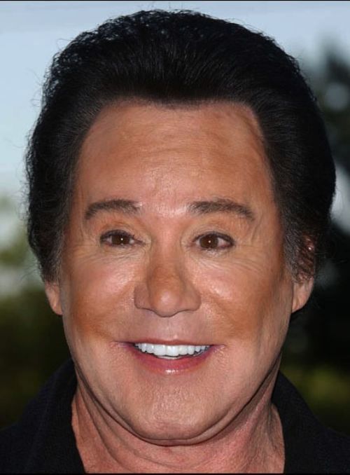 пластическая хирургия монстры, жертвый пластических операций, пластика превратились в монстров