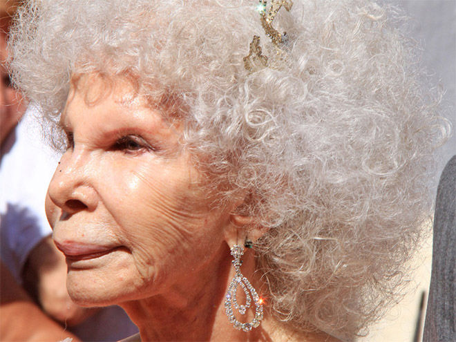 пластическая хирургия монстры, жертвый пластических операций, пластика превратились в монстров