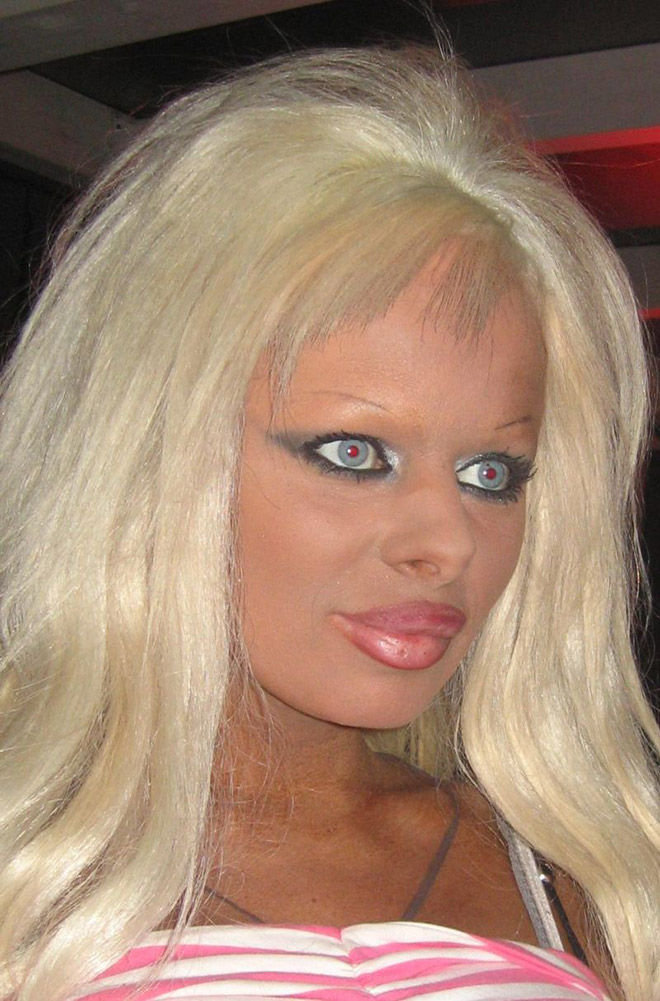 пластическая хирургия монстры, жертвый пластических операций, пластика превратились в монстров