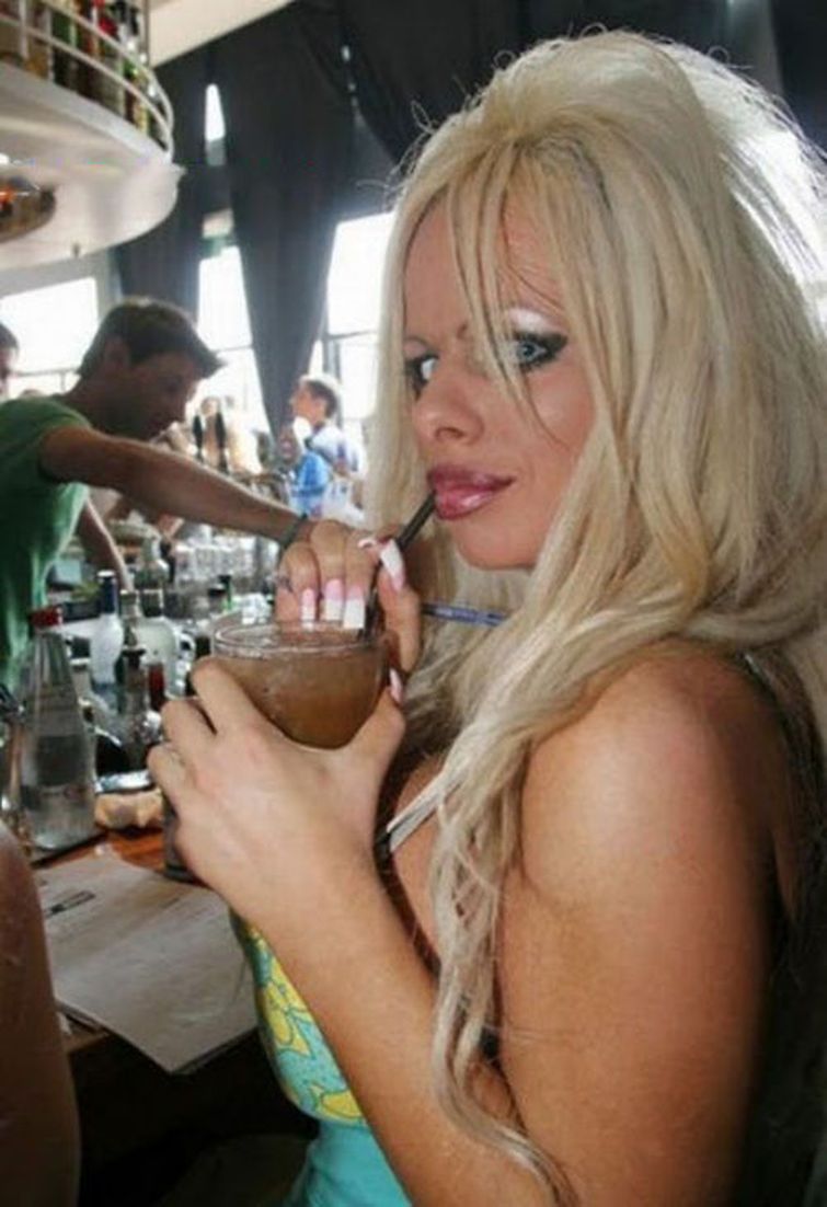 пластическая хирургия монстры, жертвый пластических операций, пластика превратились в монстров