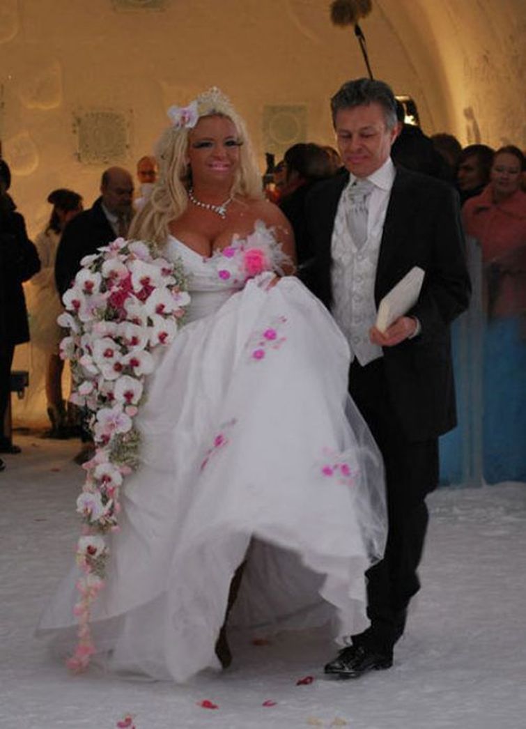 пластическая хирургия монстры, жертвый пластических операций, пластика превратились в монстров