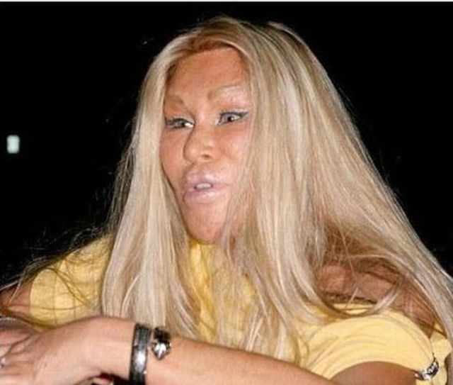 пластическая хирургия монстры, жертвый пластических операций, пластика превратились в монстров