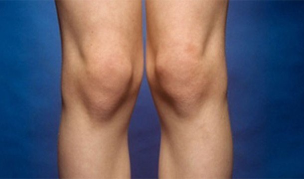 25 реальных человеческих фобий, в существование которых трудно поверить самые необычные фобии, фобии людей, необычные боязни людей, чего люди боятся