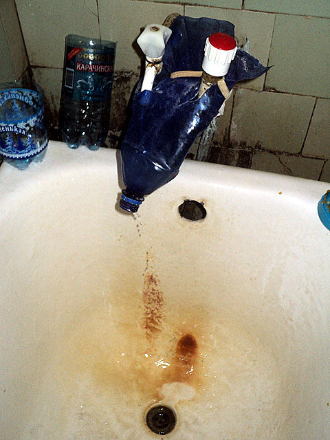 российские больницы из ада, условия больницы Россия, ужасные условия больницы, 